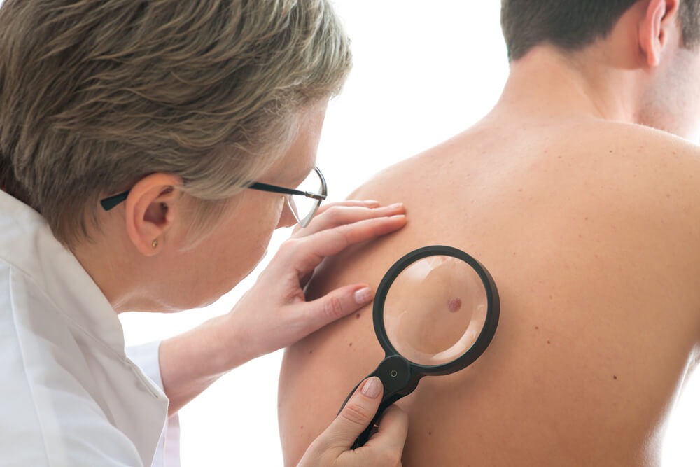 skin infection